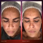 Radiant Dual Serum
