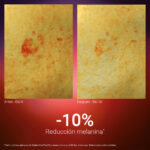 Radiant Acid Peel 10ml